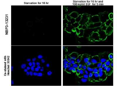 Immunocytochemistry/ Immunofluorescence: EGFR [p Tyr1148] Antibody [NBP3-13231]